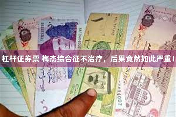 杠杆证券票 梅杰综合征不治疗，后果竟然如此严重！
